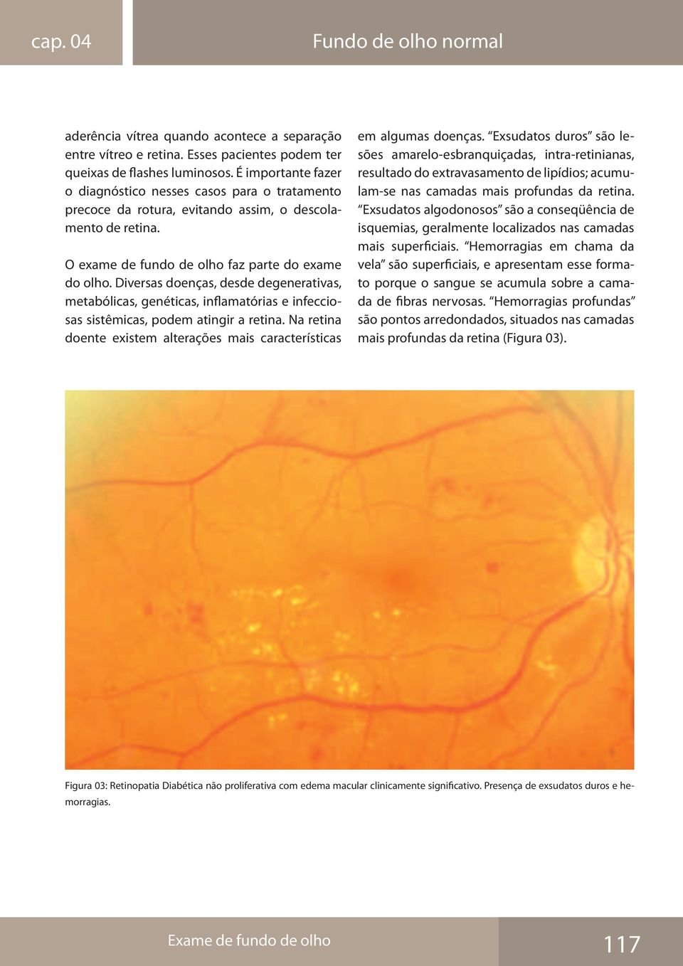 Diversas doenças, desde degenerativas, metabólicas, genéticas, inflamatórias e infecciosas sistêmicas, podem atingir a retina.