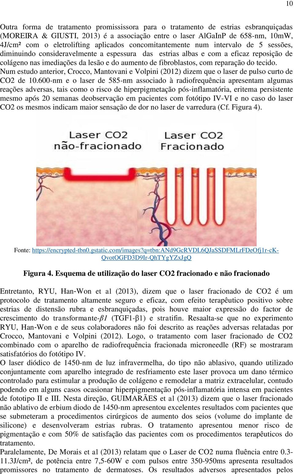 fibroblastos, com reparação do tecido. Num estudo anterior, Crocco, Mantovani e Volpini (2012) dizem que o laser de pulso curto de CO2 de 10.