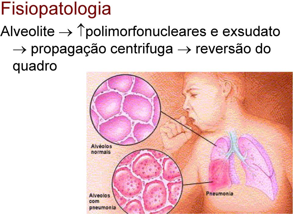 polimorfonucleares e