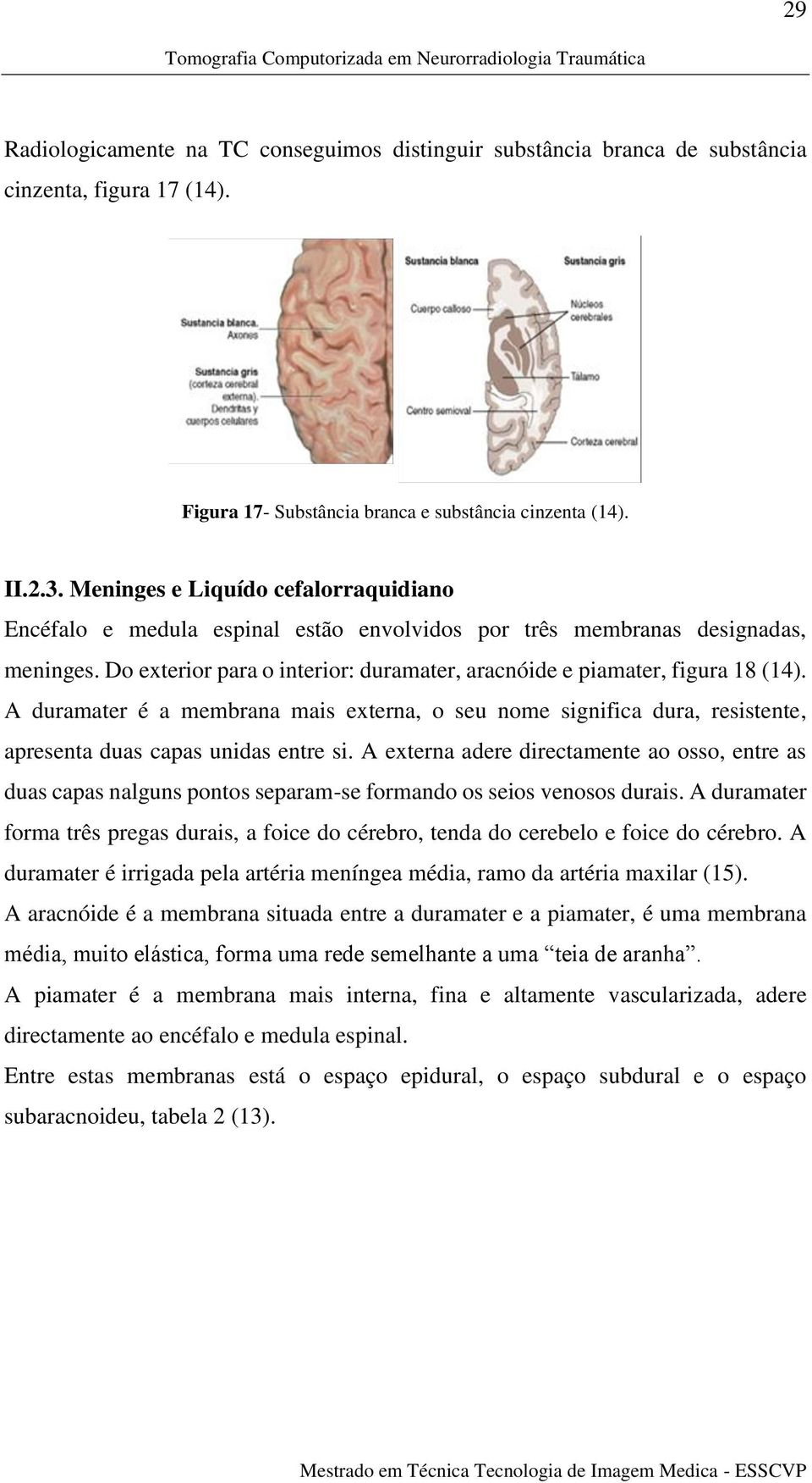 A duramater é a membrana mais externa, o seu nome significa dura, resistente, apresenta duas capas unidas entre si.