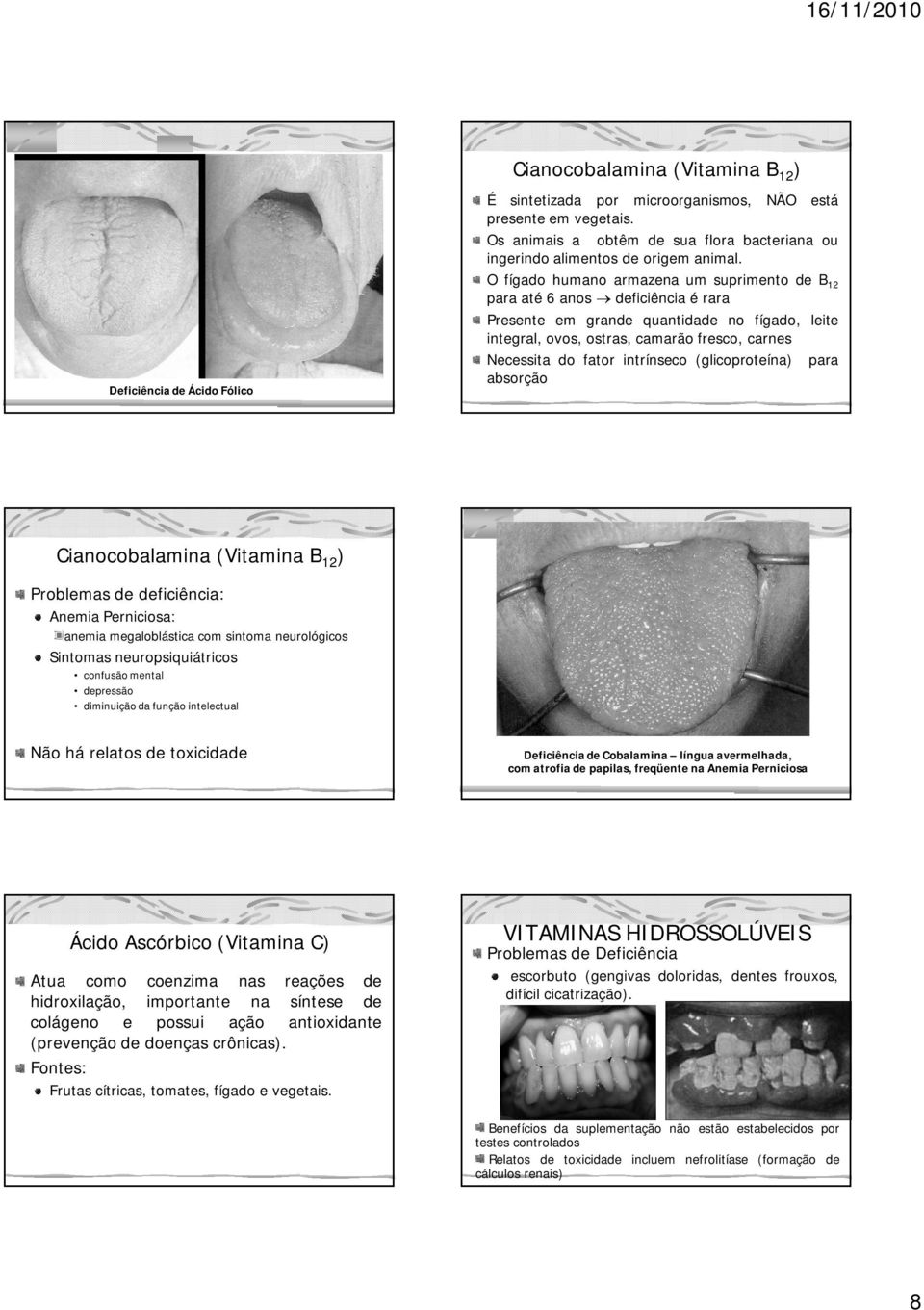 O fígado humano armazena um suprimento de B12 para até 6 anos deficiência é rara Presente em grande quantidade no fígado, leite integral, ovos, ostras, camarão fresco, carnes Necessita do fator