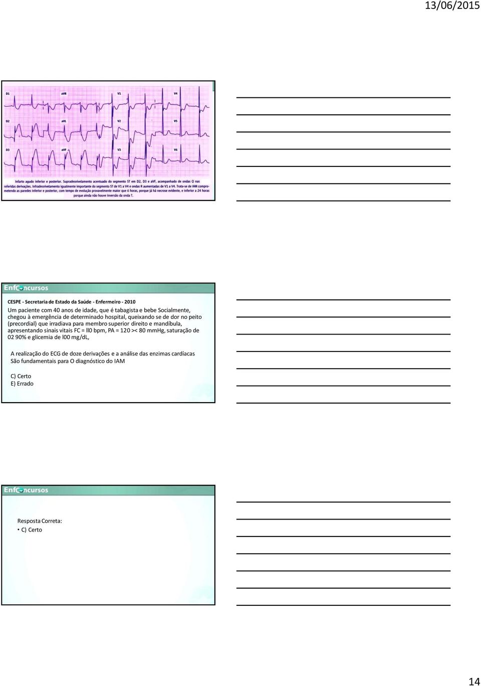 apresentando sinais vitais FC = ll0 bpm, PA = 120 >< 80 mmhg, saturação de 02 90% e glicemia de l00 mg/dl, A realização do ECG de doze