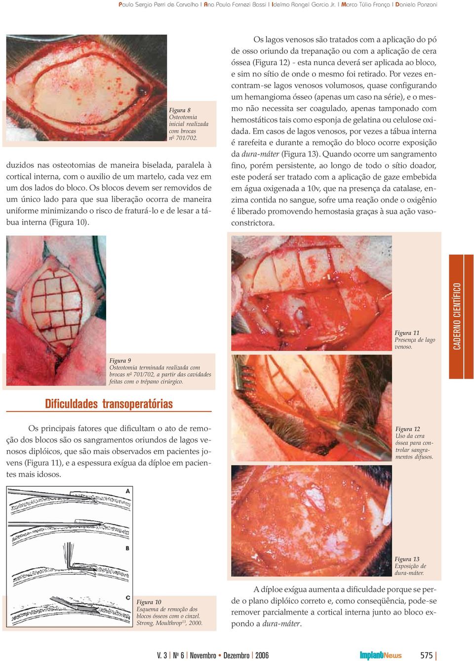 Os lagos venosos são tratados com a aplicação do pó de osso oriundo da trepanação ou com a aplicação de cera óssea (Figura 12) - esta nunca deverá ser aplicada ao bloco, e sim no sítio de onde o