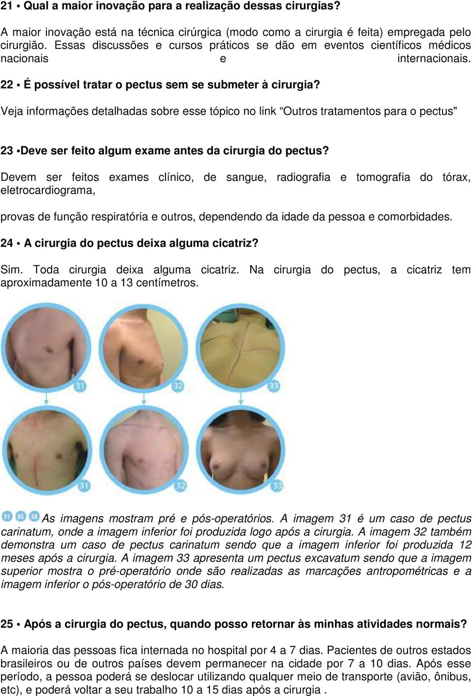 Veja informações detalhadas sobre esse tópico no link Outros tratamentos para o pectus" 23 Deve ser feito algum exame antes da cirurgia do pectus?