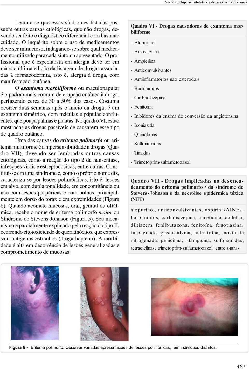 O profissional que é especialista em alergia deve ter em mãos a última edição da listagem de drogas associadas à farmacodermia, isto é, alergia à droga, com manifestação cutânea.