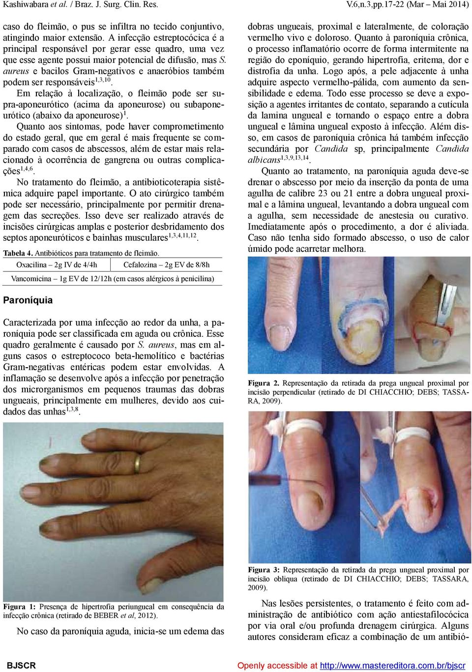 aureus e bacilos Gram-negativos e anaeróbios também podem ser responsáveis 1,3,10.