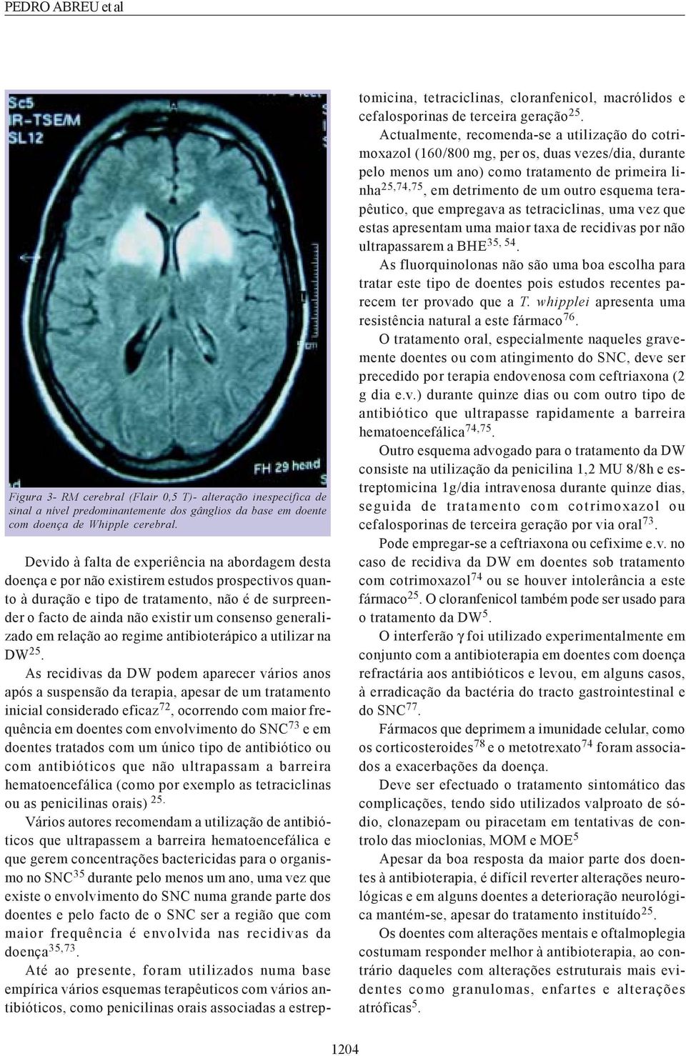 generalizado em relação ao regime antibioterápico a utilizar na DW 25.