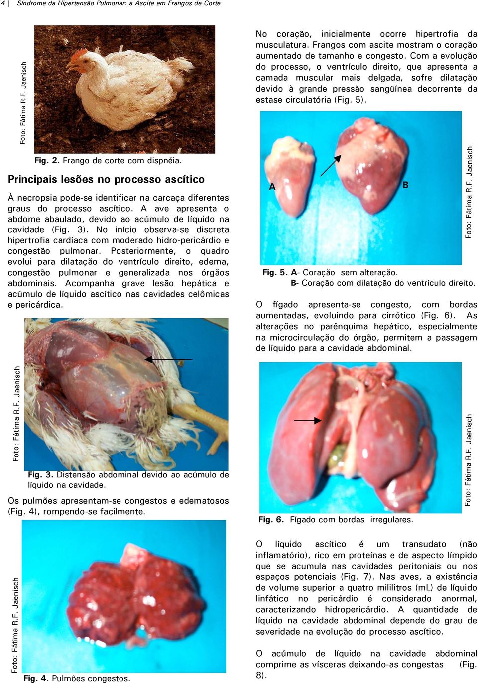 A ave apresenta o abdome abaulado, devido ao acúmulo de líquido na cavidade (Fig. 3). No início observa-se discreta hipertrofia cardíaca com moderado hidro-pericárdio e congestão pulmonar.