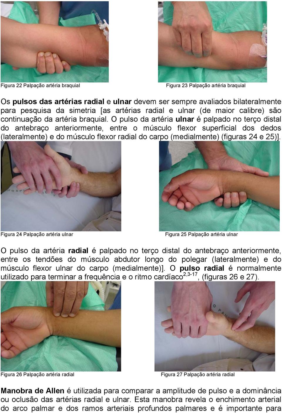 O pulso da artéria ulnar é palpado no terço distal do antebraço anteriormente, entre o músculo flexor superficial dos dedos (lateralmente) e do músculo flexor radial do carpo (medialmente) (figuras