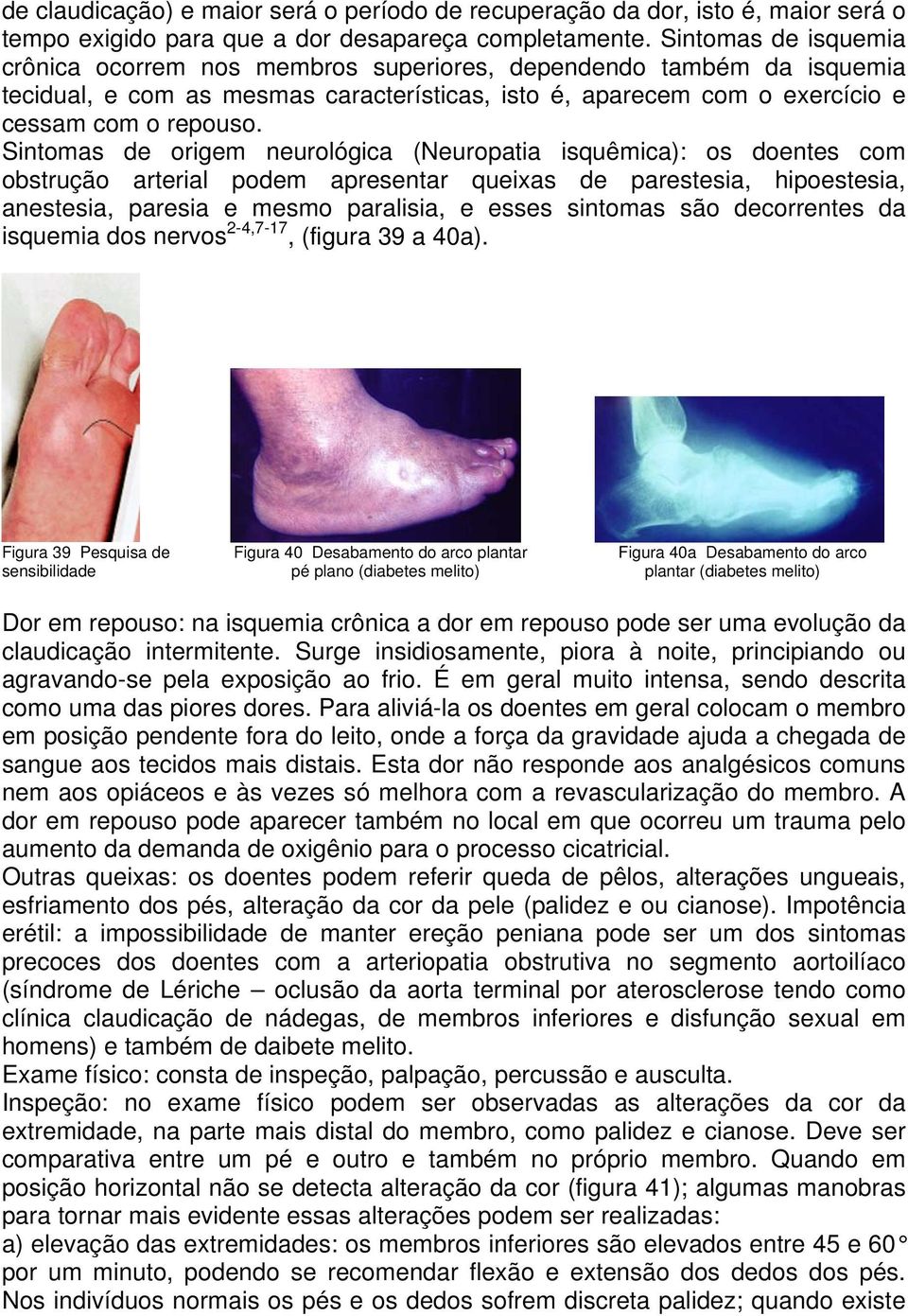 Sintomas de origem neurológica (Neuropatia isquêmica): os doentes com obstrução arterial podem apresentar queixas de parestesia, hipoestesia, anestesia, paresia e mesmo paralisia, e esses sintomas