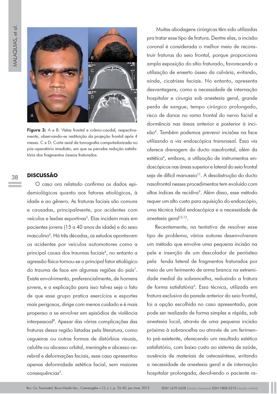 DISCUSSÃO O caso ora relatado confirma os dados epidemiológicos quanto aos fatores etiológicos, à idade e ao gênero.