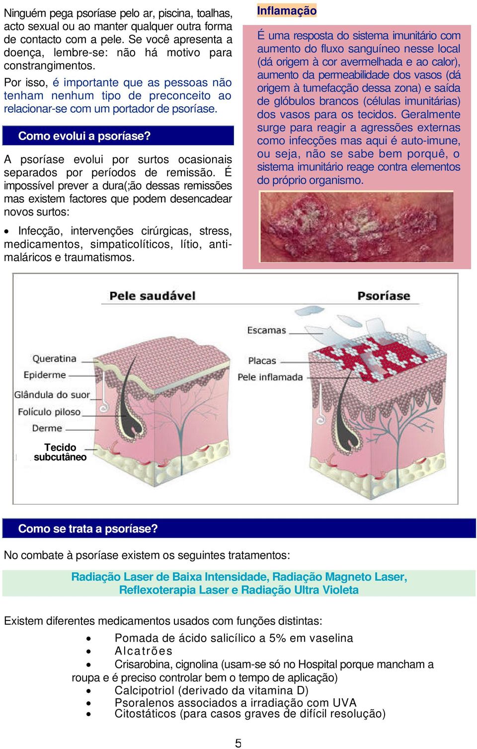 A psoríase evolui por surtos ocasionais separados por períodos de remissão.