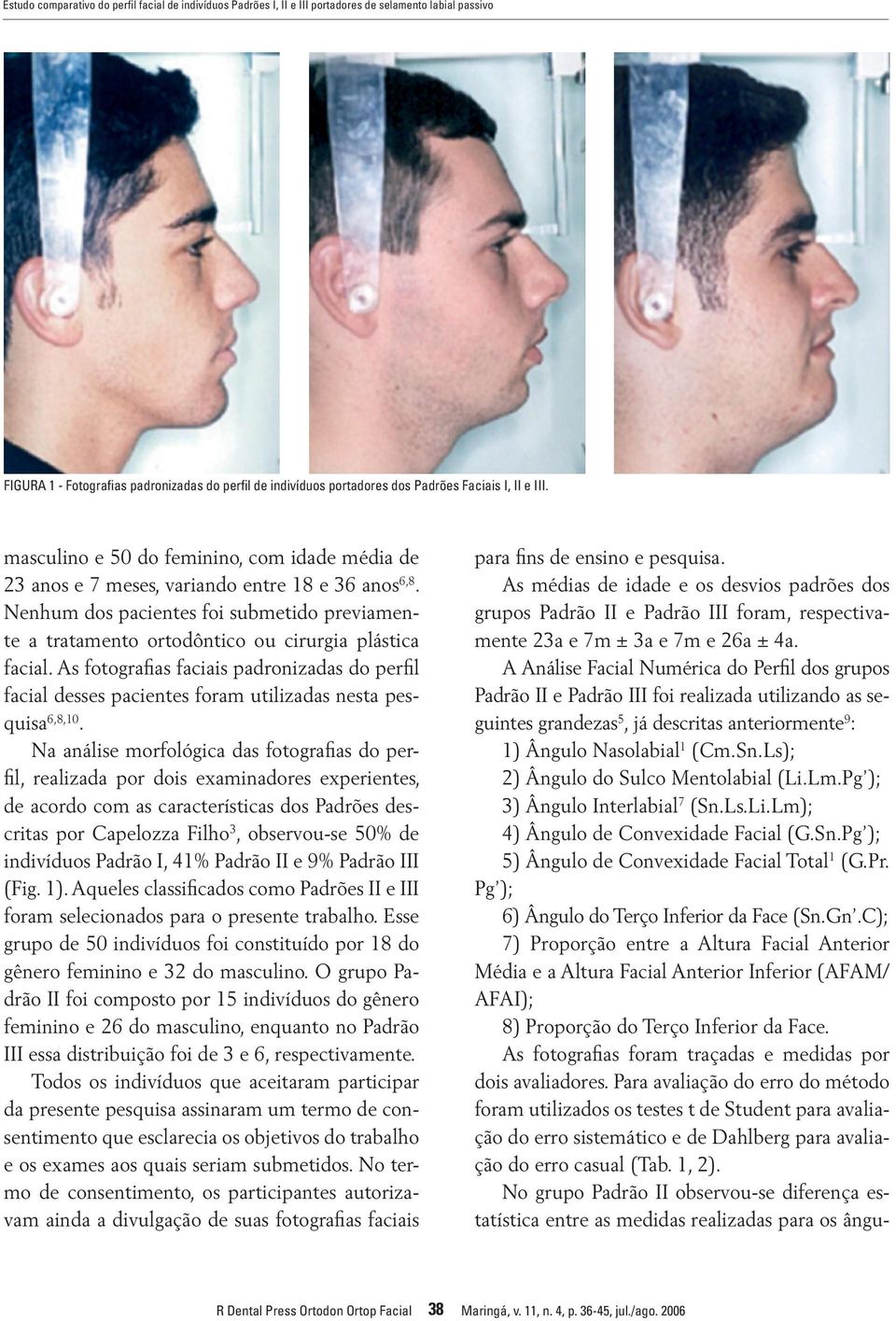 Nenhum dos pacientes foi submetido previamente a tratamento ortodôntico ou cirurgia plástica facial.