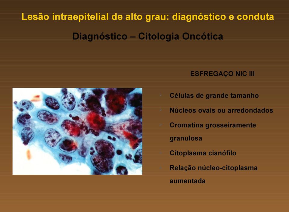 grande tamanho Núcleos ovais ou arredondados Cromatina
