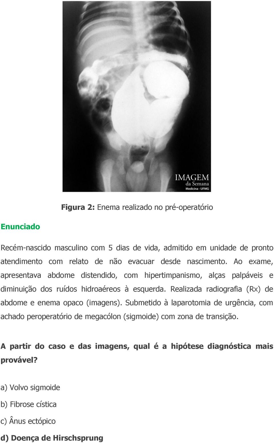 Realizada radiografia (Rx) de abdome e enema opaco (imagens).