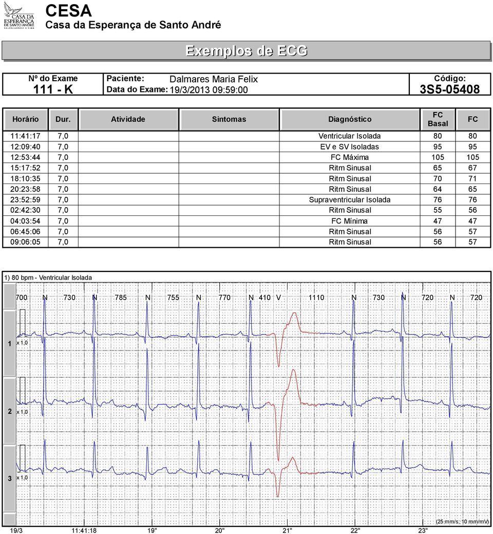 7, Ritm Sinusal 65 67 8::5 7, Ritm Sinusal 7 7 ::58 7, Ritm Sinusal 64 65 :5:59 7, Supraventricular Isolada 76 76 :4: 7, Ritm