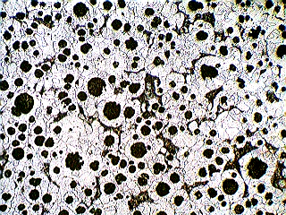 1.1 Figura 23 Micrografia do fundido obtido