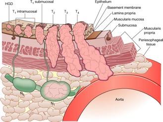 O QUE É? TUMOR Termo empregado originalmente para denominar crescimento causado pela inflamação.