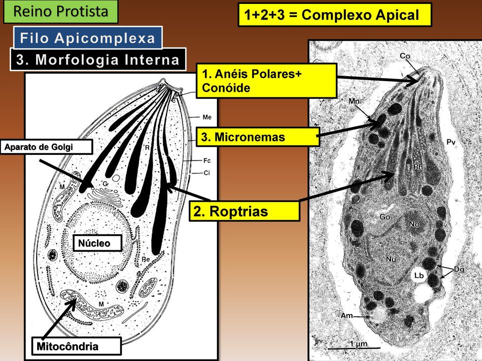 Anéis Polares+ Conóide 3.