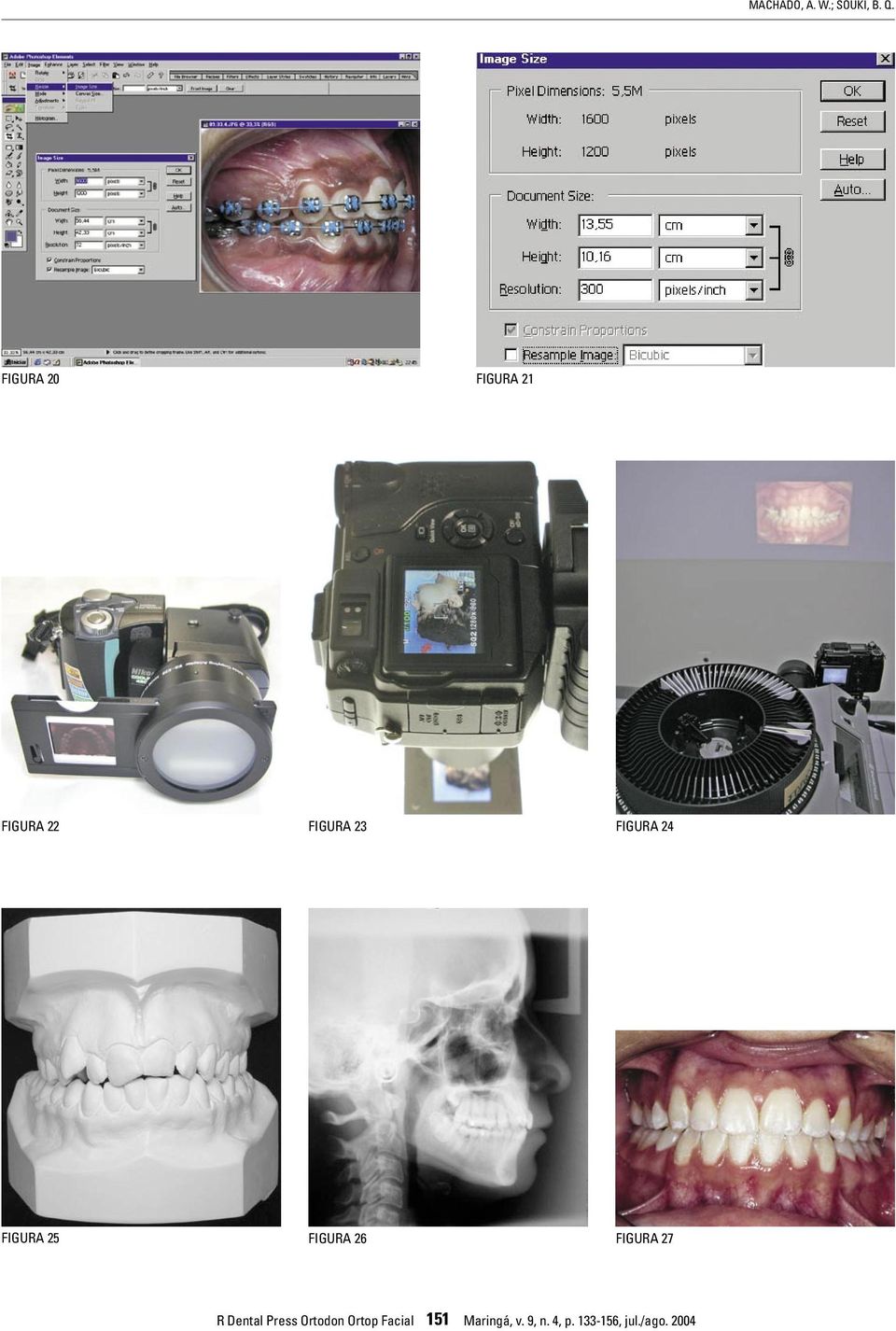 24 FIGURA 25 FIGURA 26 FIGURA 27 R Dental Press