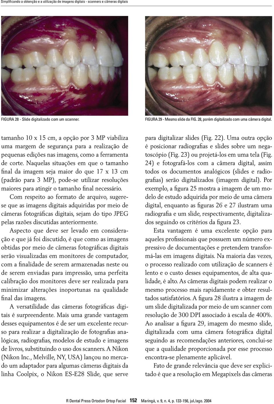 Naquelas situações em que o tamanho final da imagem seja maior do que 17 x 13 cm (padrão para 3 MP), pode-se utilizar resoluções maiores para atingir o tamanho final necessário.