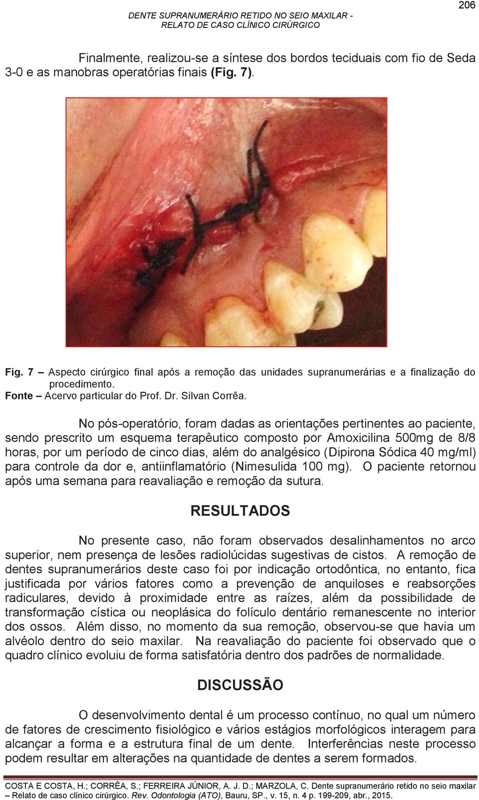 No pós-operatório, foram dadas as orientações pertinentes ao paciente, sendo prescrito um esquema terapêutico composto por Amoxicilina 500mg de 8/8 horas, por um período de cinco dias, além do