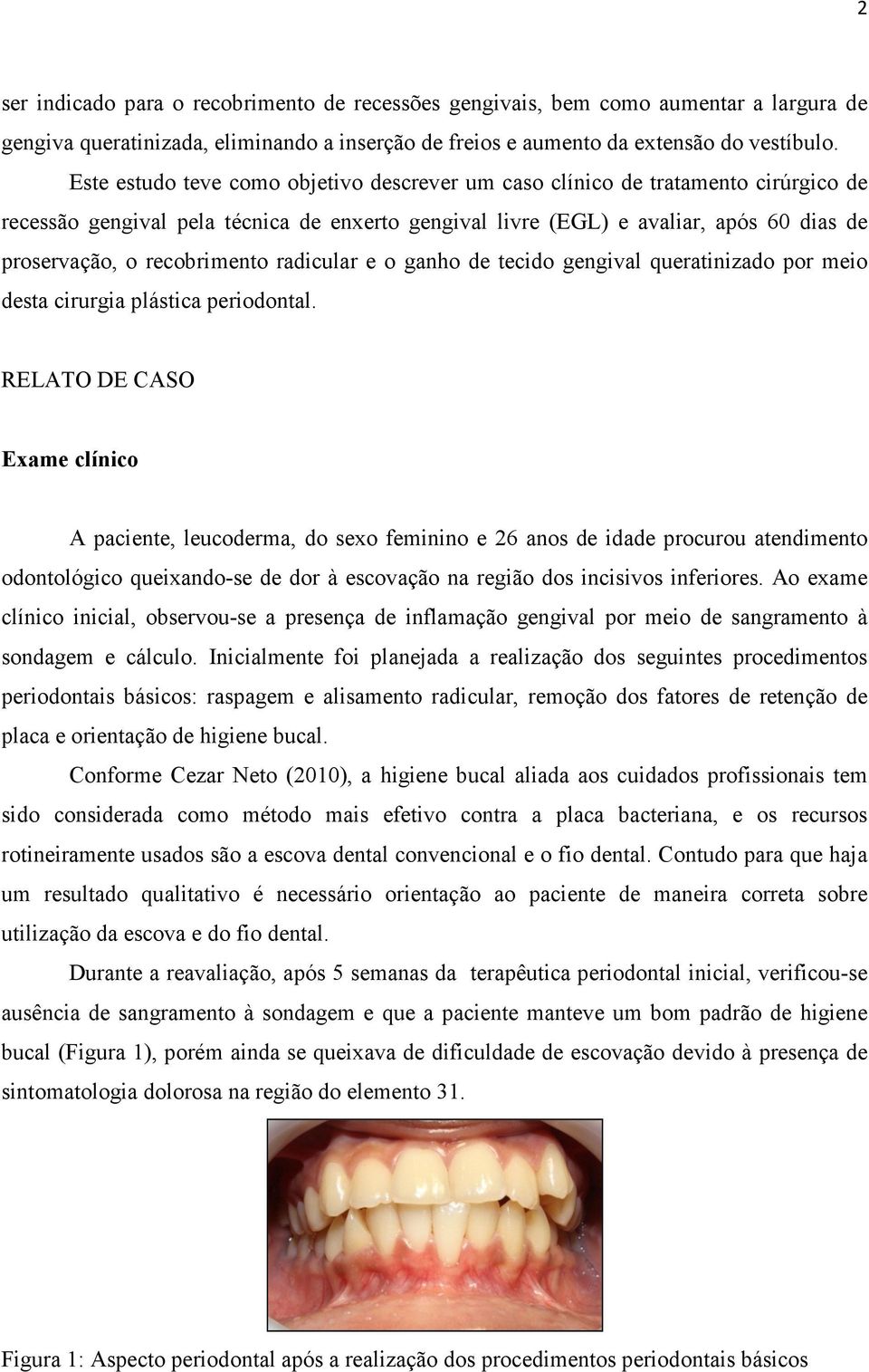 recobrimento radicular e o ganho de tecido gengival queratinizado por meio desta cirurgia plástica periodontal.