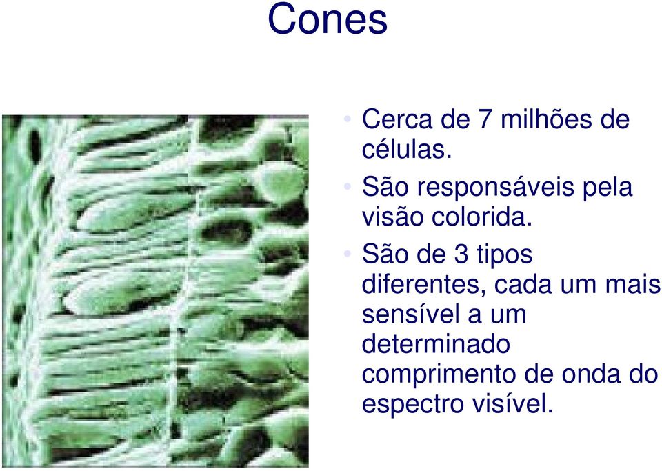 São de 3 tipos diferentes, cada um mais