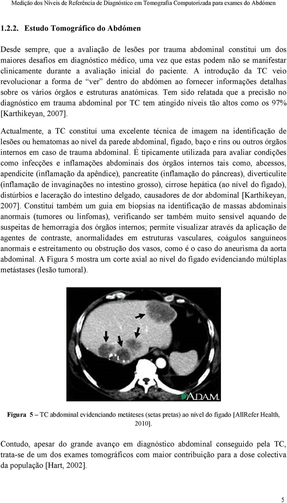 A introdução da TC veio revolucionar a forma de ver dentro do abdómen ao fornecer informações detalhas sobre os vários órgãos e estruturas anatómicas.