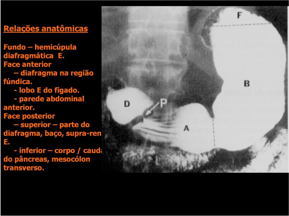 - parede abdominal anterior.