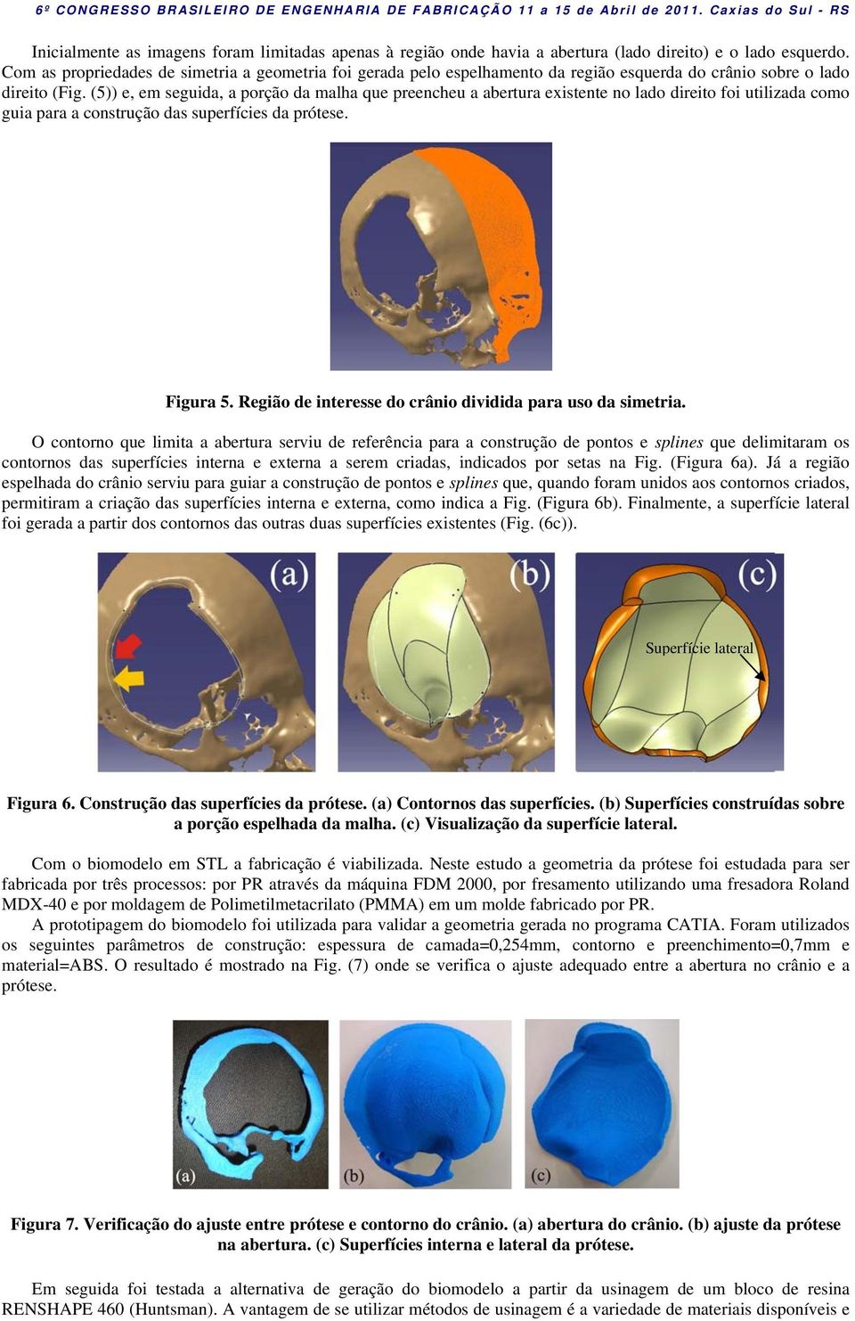 (5)) e, em seguida, a porção da malha que preencheu a abertura existente no lado direito foi utilizada como guia para a construção das superfícies da prótese. Figura 5.