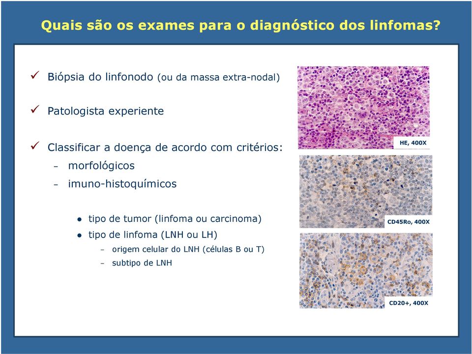 doença de acordo com critérios: morfológicos imuno-histoquímicos HE, 400X tipo de tumor