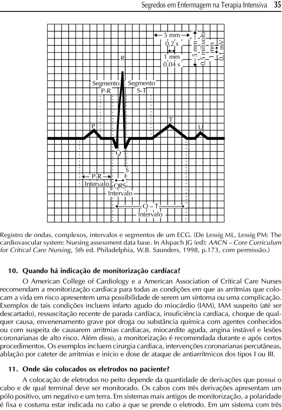 In Alspach JG (ed): AACN Core Curriculum for Critical Care Nursing, 5th ed. Philadelphia, W.B. Saunders, 1998, p.173, com permissão.) 10. Quando há indicação de monitorização cardíaca?