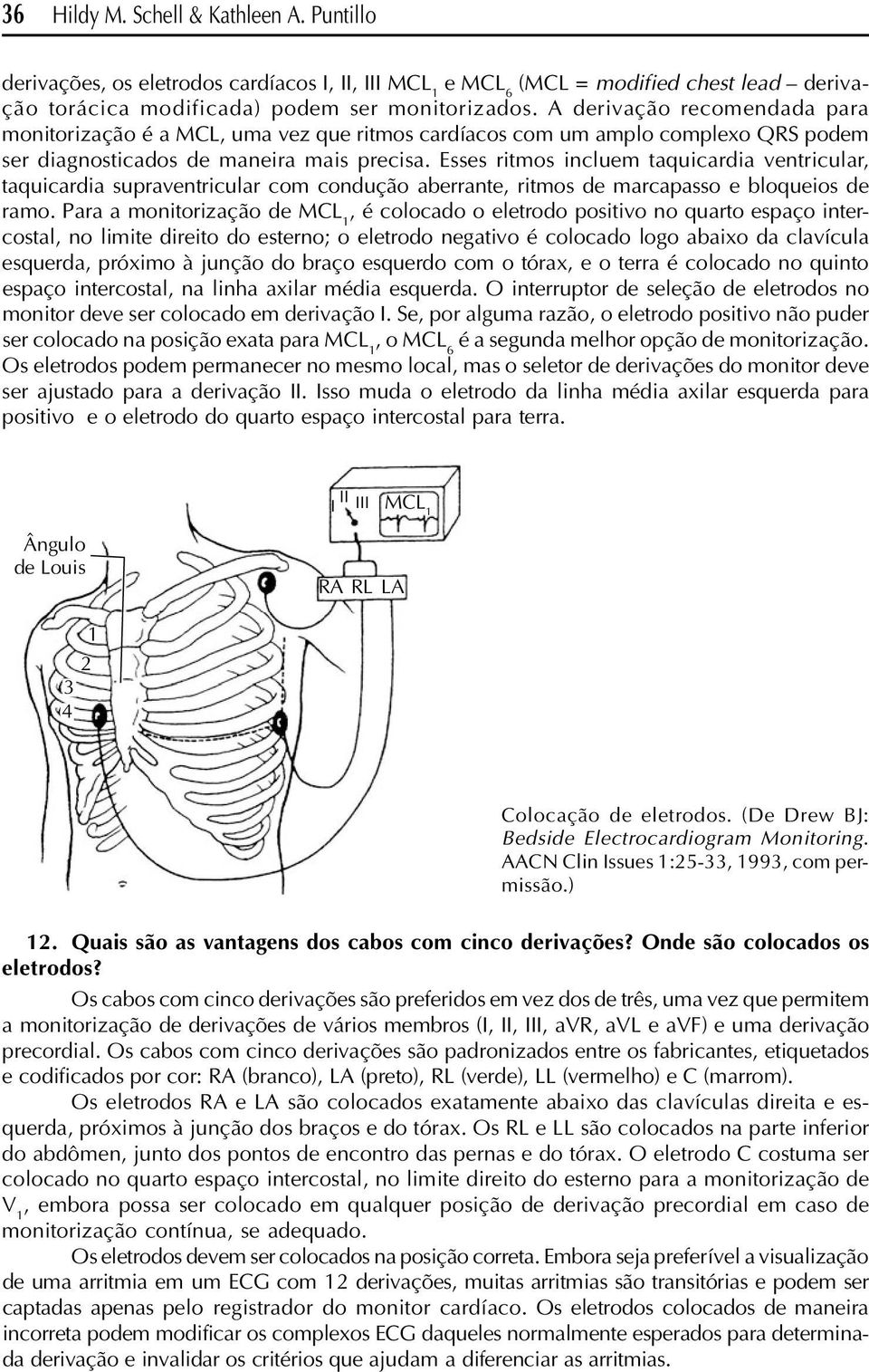 Esses ritmos incluem taquicardia ventricular, taquicardia supraventricular com condução aberrante, ritmos de marcapasso e bloqueios de ramo.