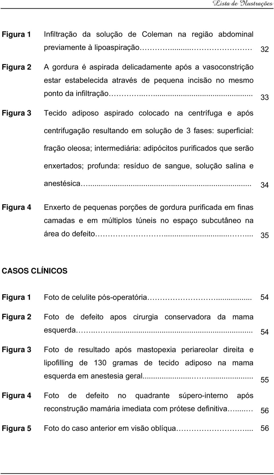 ..... Tecido adiposo aspirado colocado na centrífuga e após centrifugação resultando em solução de 3 fases: superficial: fração oleosa; intermediária: adipócitos purificados que serão enxertados;