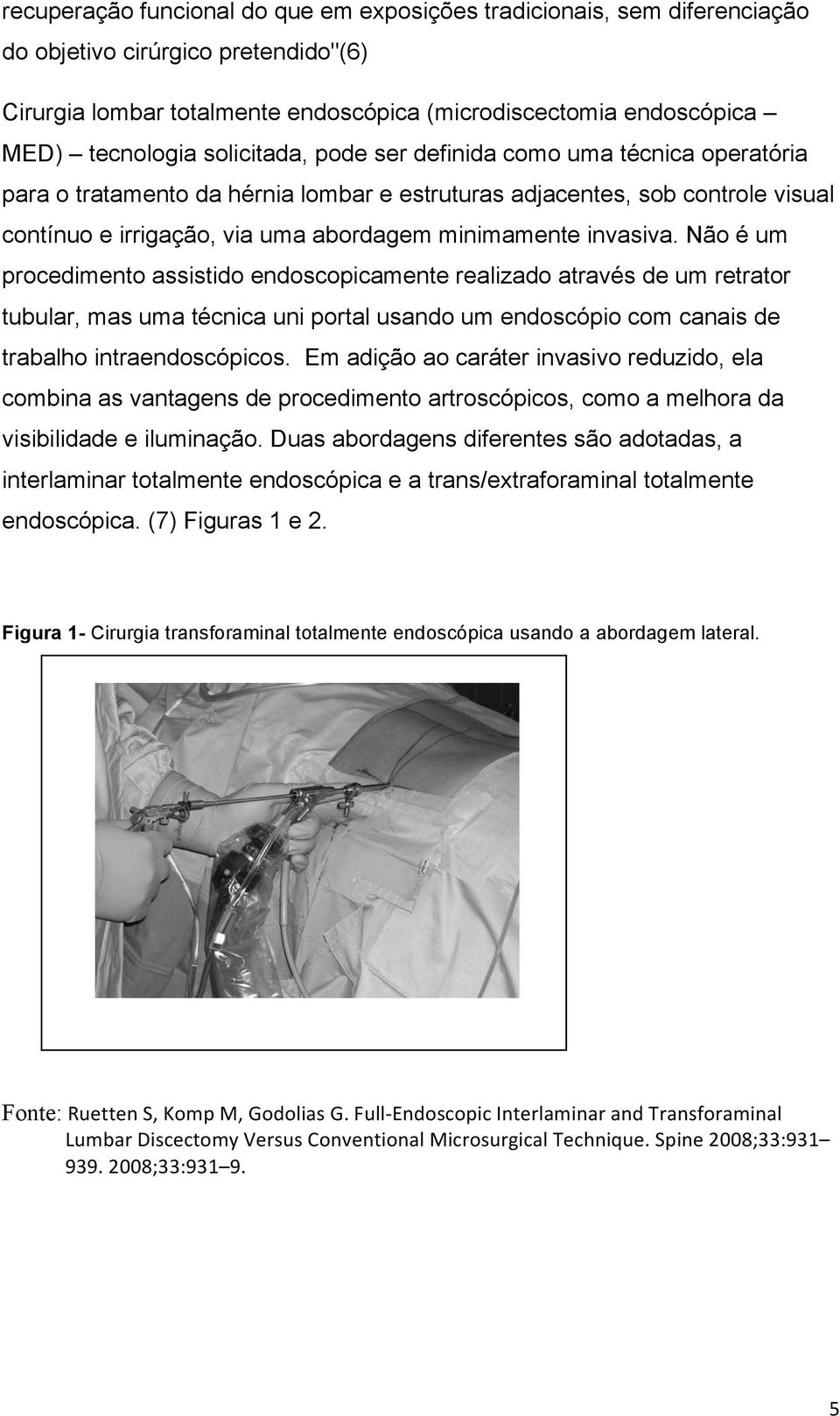 Não é um procedimento assistido endoscopicamente realizado através de um retrator tubular, mas uma técnica uni portal usando um endoscópio com canais de trabalho intraendoscópicos.