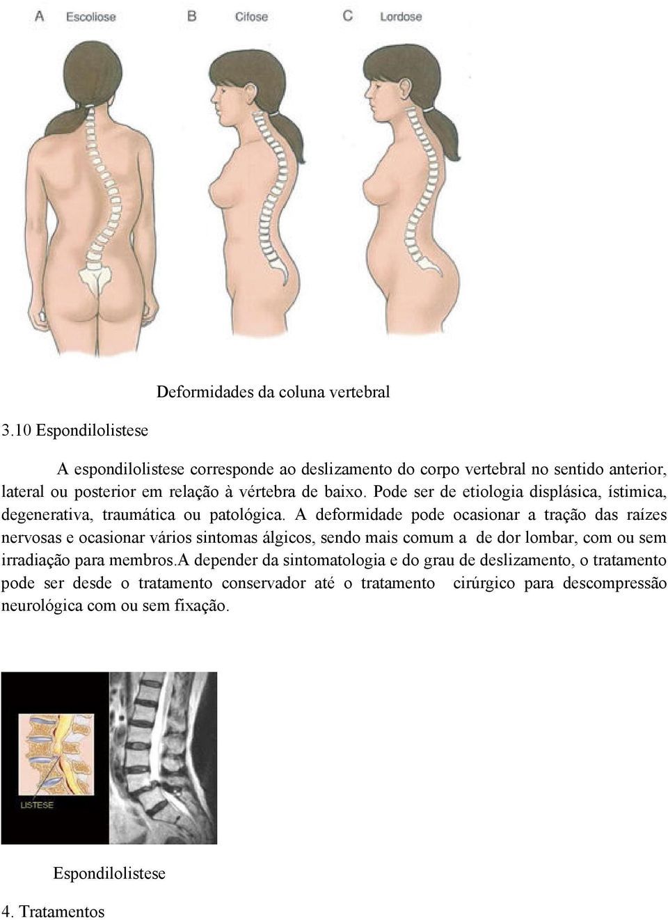 Pode ser de etiologia displásica, ístimica, degenerativa, traumática ou patológica.