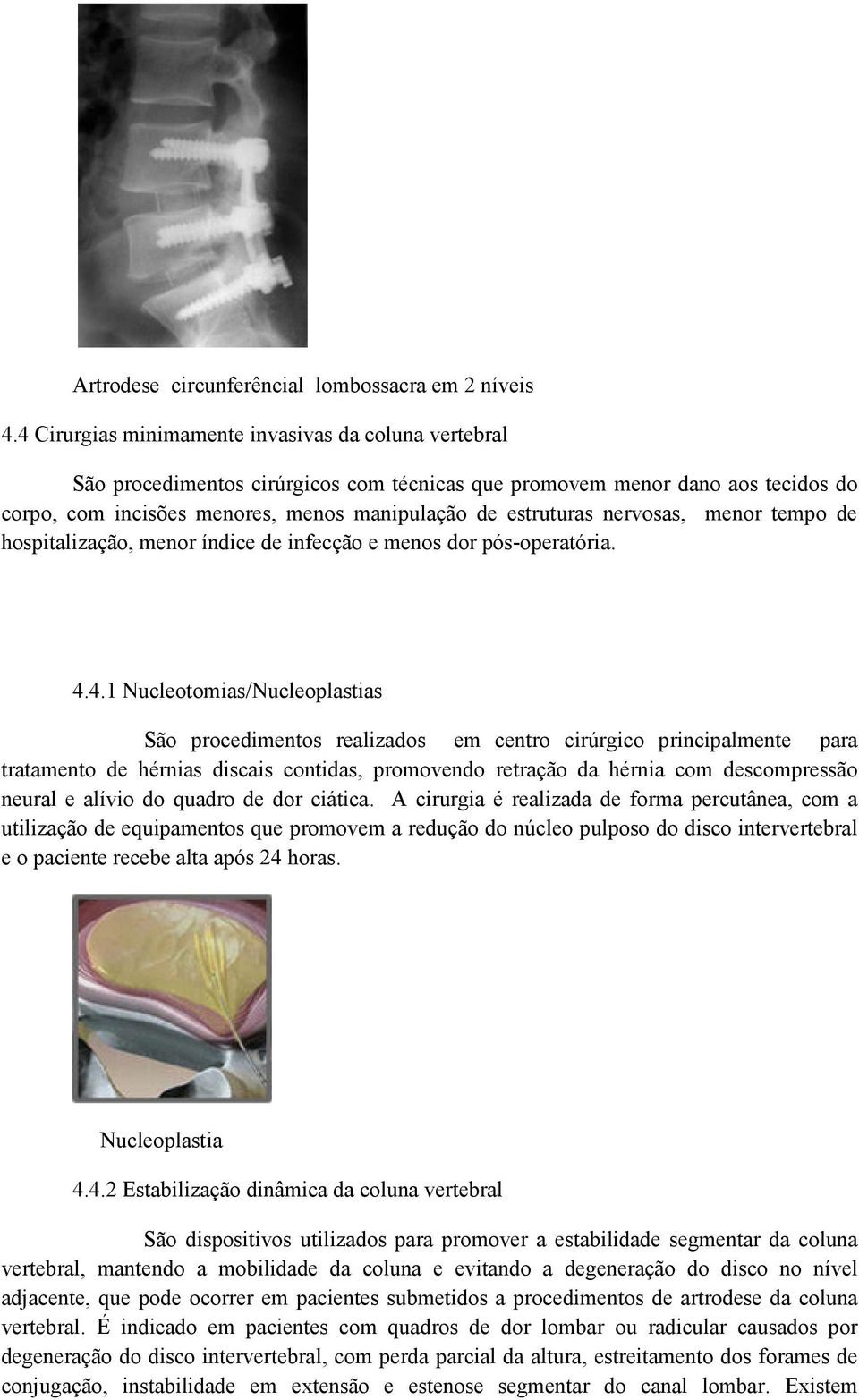 nervosas, menor tempo de hospitalização, menor índice de infecção e menos dor pós-operatória. 4.