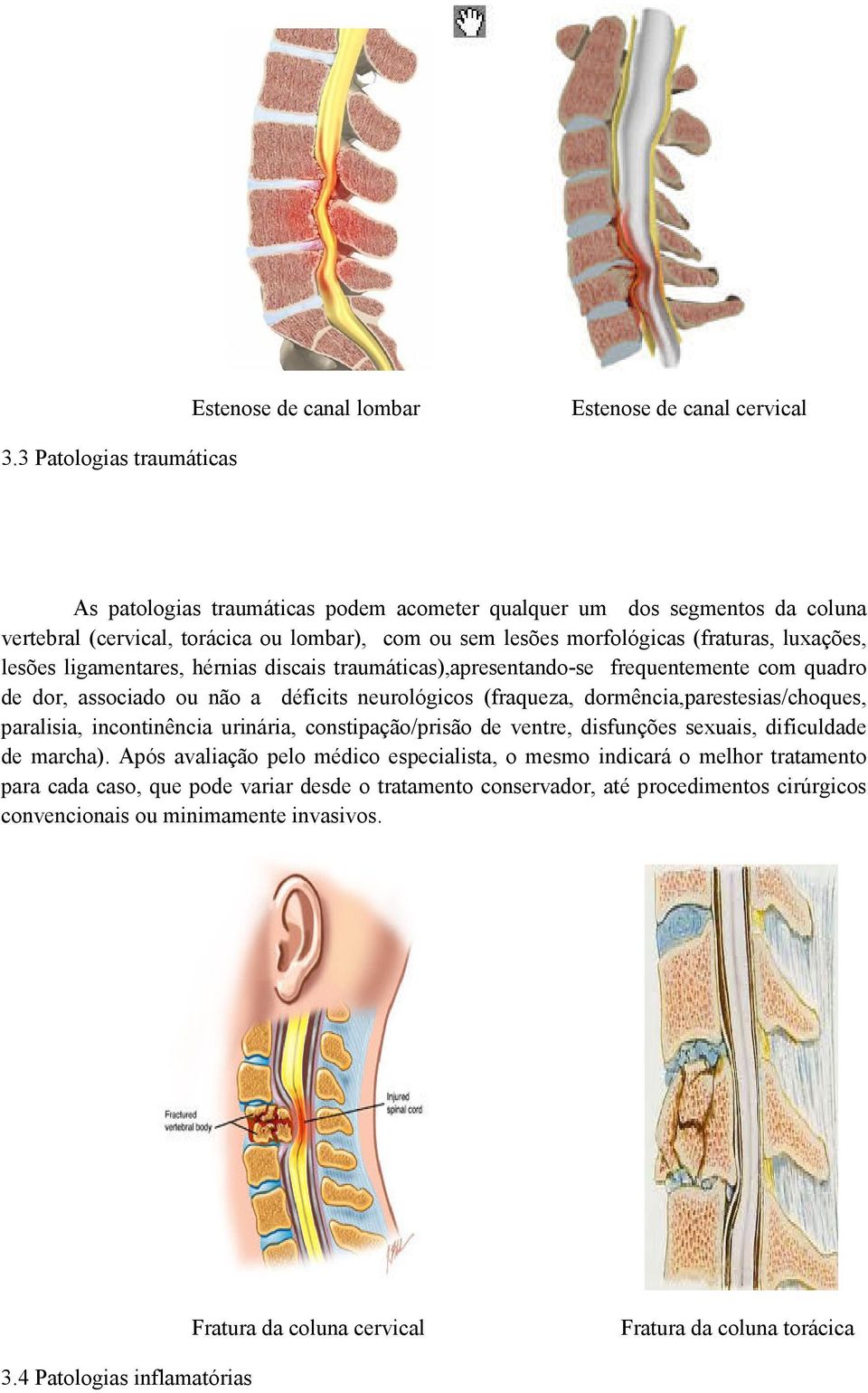 lesões ligamentares, hérnias discais traumáticas),apresentando-se frequentemente com quadro de dor, associado ou não a déficits neurológicos (fraqueza, dormência,parestesias/choques, paralisia,