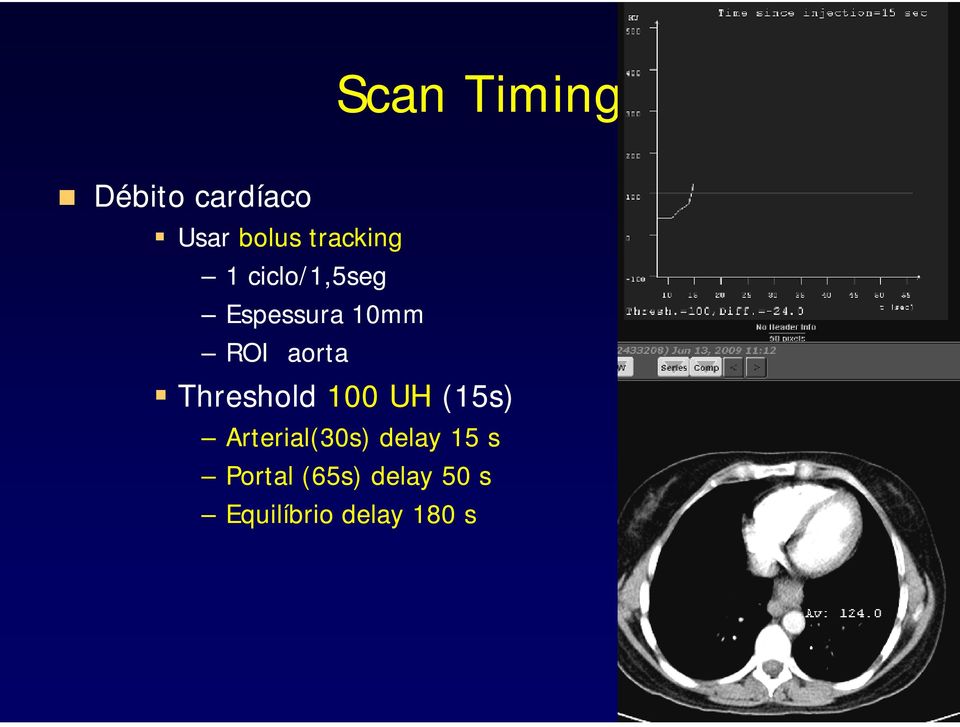 aorta Threshold 100 UH (15s) Arterial(30s)