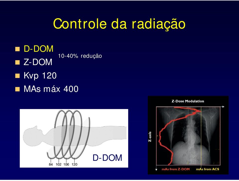 Z-DOM Kvp 120 MAs