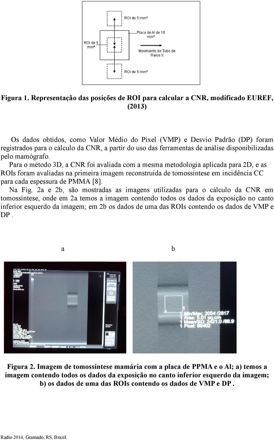 partir do uso das ferramentas de análise disponibilizadas pelo mamógrafo.