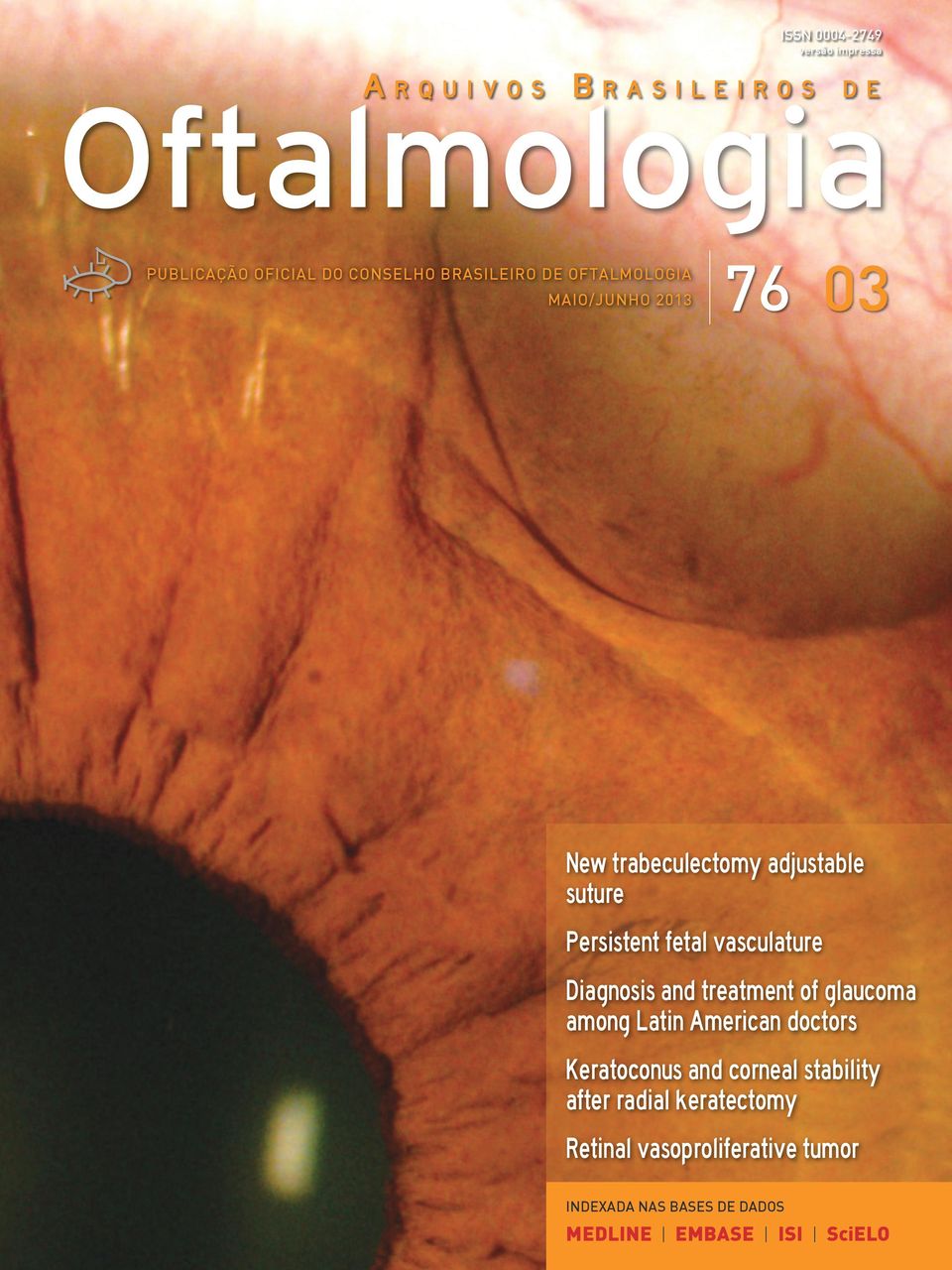 vasculature Diagnosis and treatment of glaucoma among Latin American doctors Keratoconus and corneal