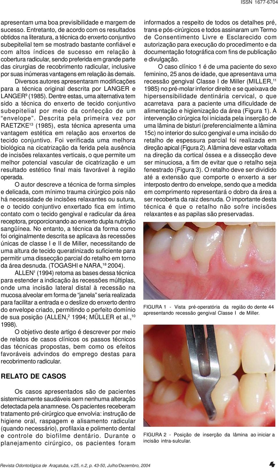 radicular, sendo preferida em grande parte das cirurgias de recobrimento radicular, inclusive por suas inúmeras vantagens em relação às demais.