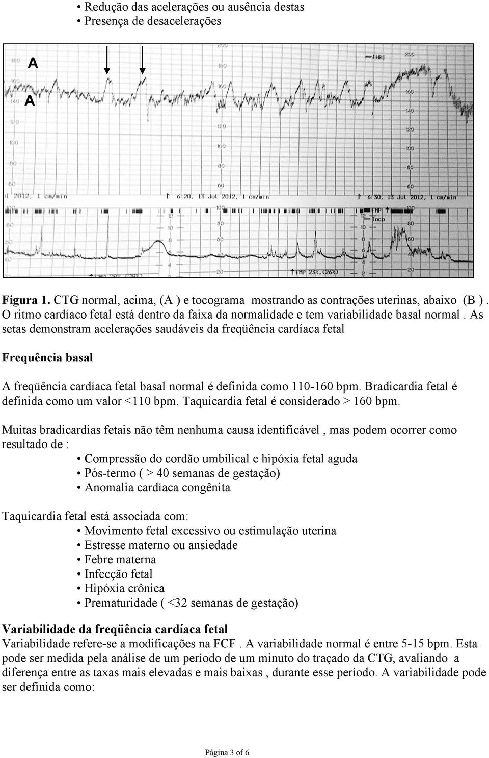 As setas demonstram acelerações saudáveis da freqüência cardíaca fetal Frequência basal A freqüência cardíaca fetal basal normal é definida como 110-160 bpm.