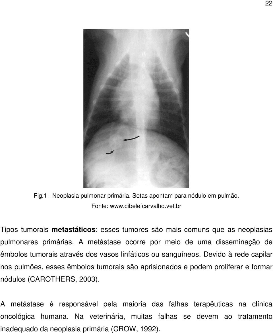 A metástase ocorre por meio de uma disseminação de êmbolos tumorais através dos vasos linfáticos ou sanguíneos.