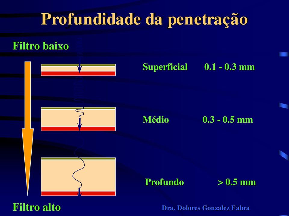 1-0.3 mm Médio 0.3-0.