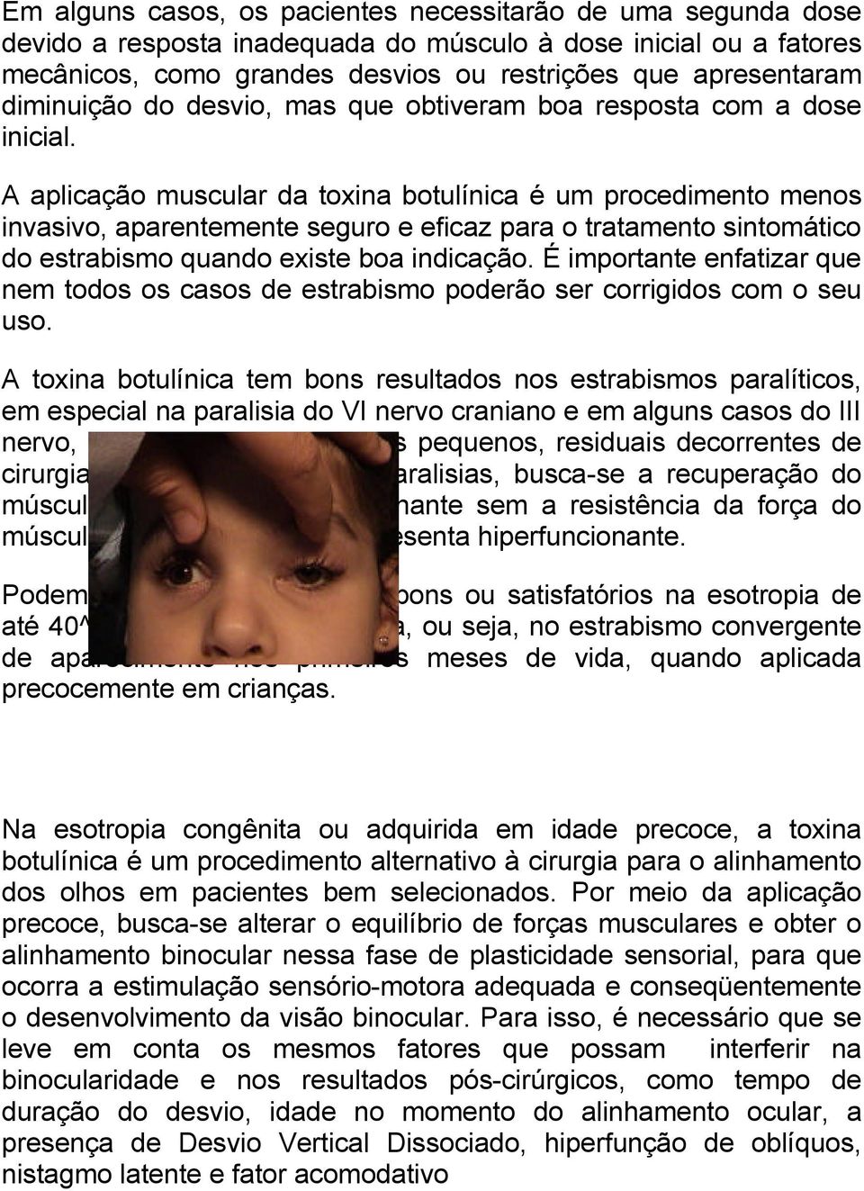 A aplicação muscular da toxina botulínica é um procedimento menos invasivo, aparentemente seguro e eficaz para o tratamento sintomático do estrabismo quando existe boa indicação.