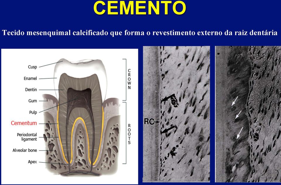 calcificado que forma