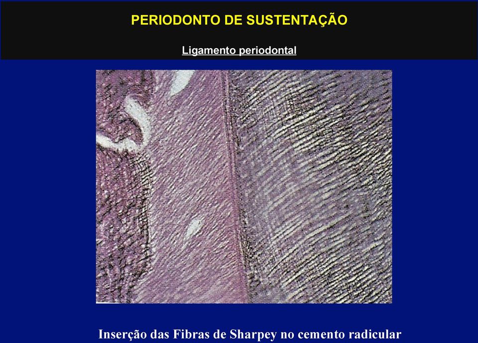 periodontal Inserção das